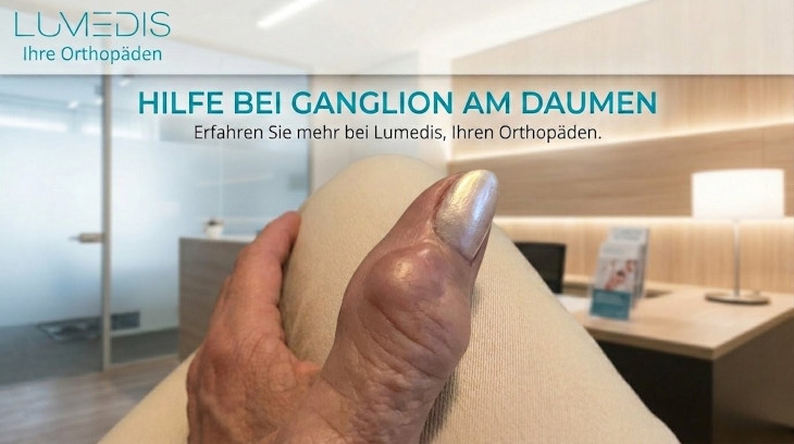 Ganglion am Daumen Ganglion am Daumen