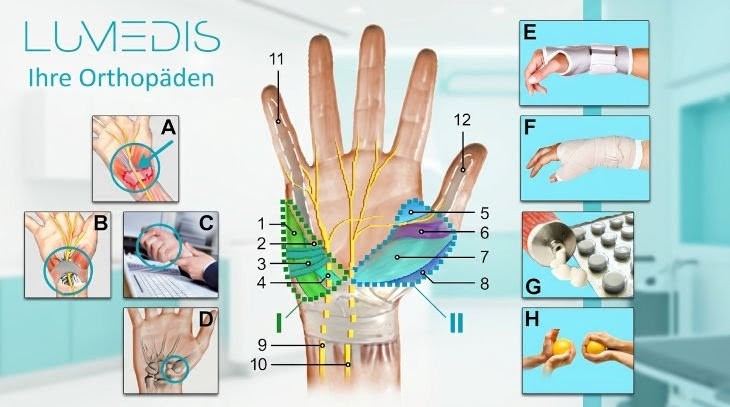 Ursachen für Schmerzen im Handballen Ursachen für Schmerzen im Handballen