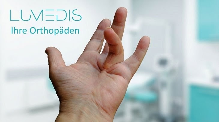 Morbus Dupuytren des Ringfingers Morbus Dupuytren des Ringfingers