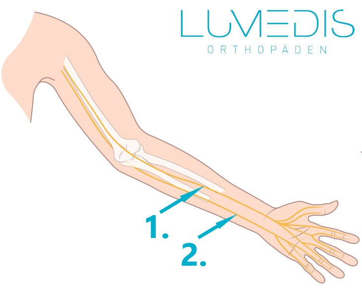 Verlauf des N. medianus und ulnaris im Arm