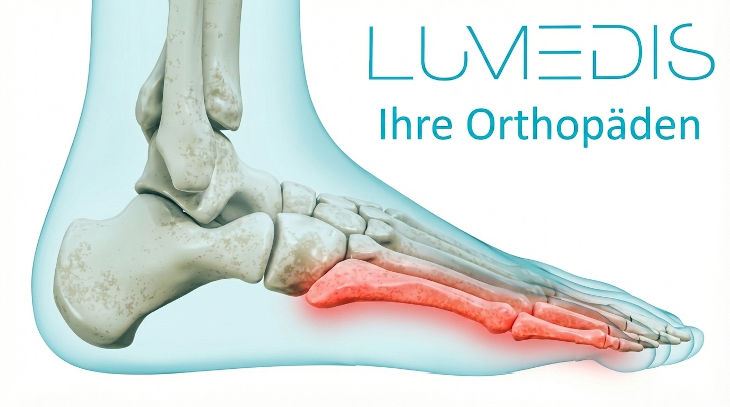 Schmerzen an der Außenkante vom Fuß Schmerzen an der Außenkante vom Fuß