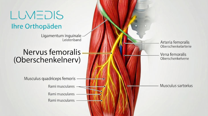 Anatomische Abbildung des Verlaufs des Nervus femoralis Anatomische Abbildung des Verlaufs des Nervus femoralis