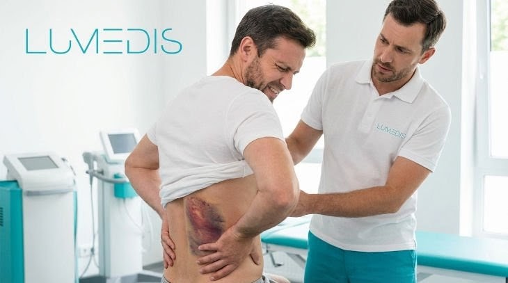 Bild einer schweren Rückenprellung Bild einer schweren Rückenprellung