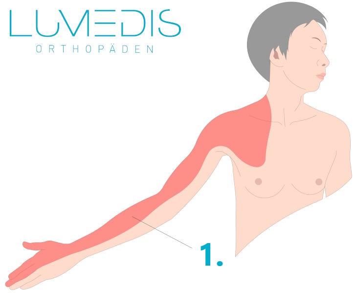 Schmerzen bei einem Thoracic-outlet-Syndrom