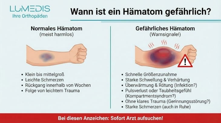 Wann ist ein Hämatom gefährlich? Wann ist ein Hämatom gefährlich?